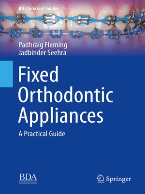 cover image of Fixed Orthodontic Appliances